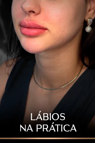 Módulo 3